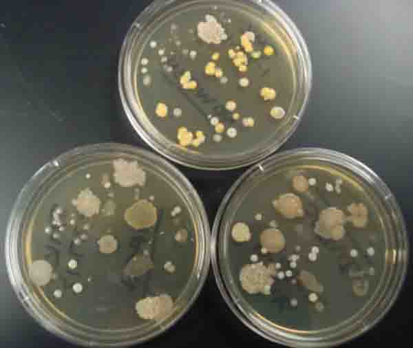 Bacterial Colony Photos  Revolution Of Bacteria
